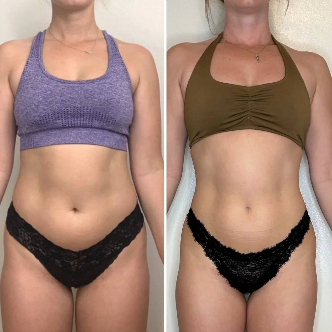 Before and after front-view photos of a coaching client in a sports bra